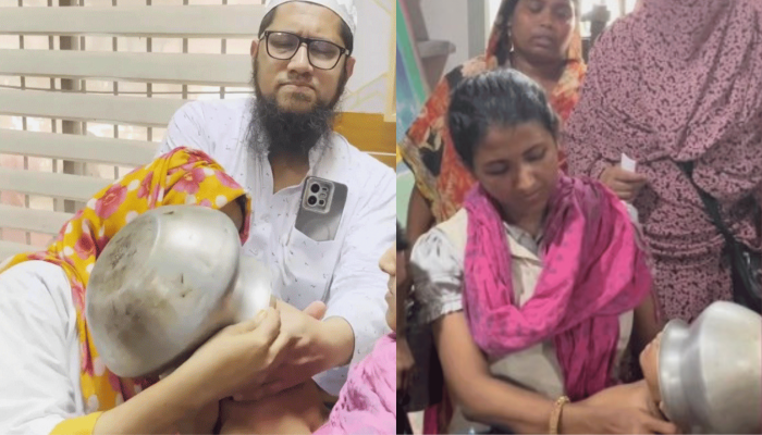 হাসপাতাল ব্যর্থ, ওয়ার্কশপে পাতিল কেটে শিশুর প্রাণ বাঁচালেন চিকিৎসক