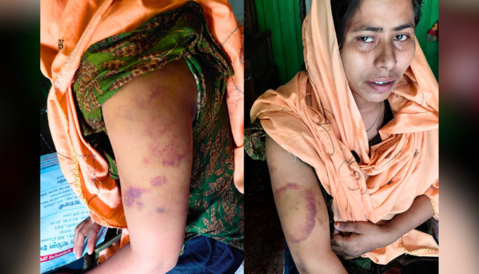 কমলনগরে কুপ্রস্তাব প্রত্যাখ্যান করায় নারীকে ধর্ষণচেষ্টা ও মারধর, আদালতে মামলা